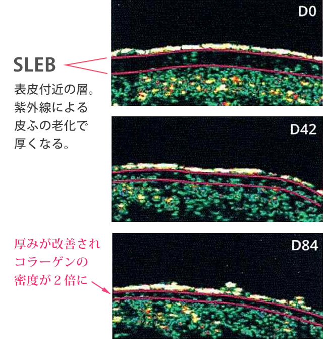 コラーゲン密度2倍