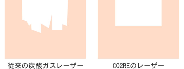 肌の断面