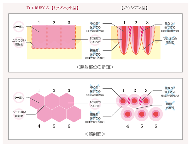 トップハット型