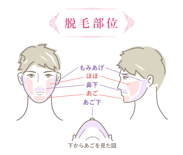 脱毛部位