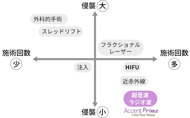 アクセントプライムの低侵襲性