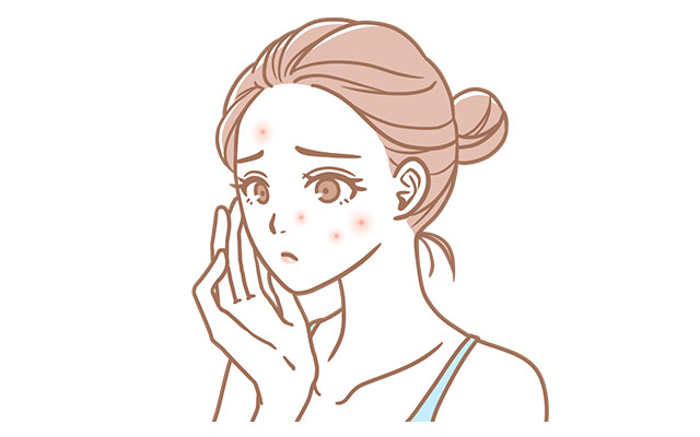 赤み・にきび痕